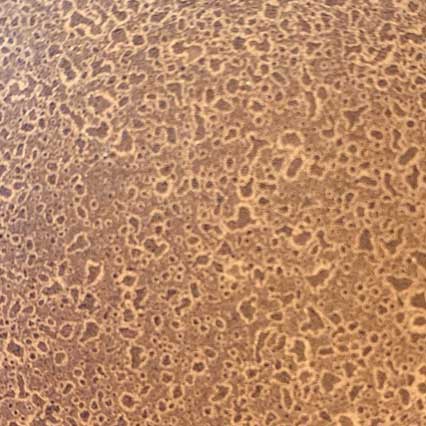 A microscopic view of densely packed cells with oval-shaped nuclei arranged in a honeycomb-like pattern, showing brown and tan coloration typical of histological tissue staining.